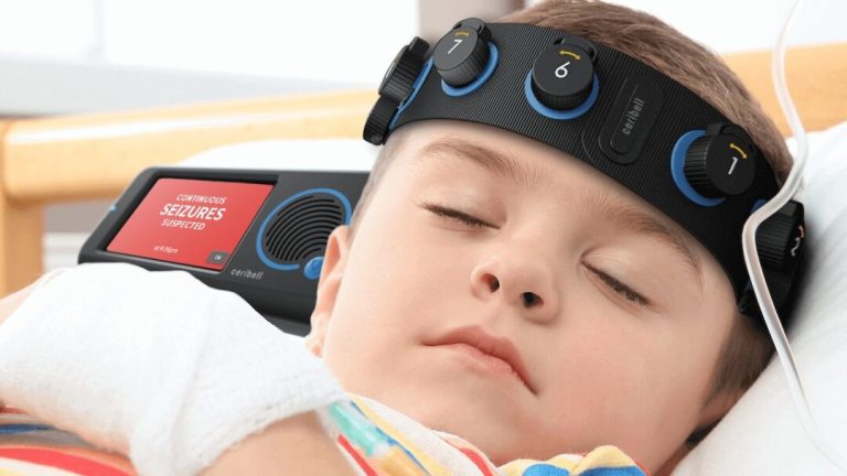 AI tech helps Valley medical doctors detect non-convulsive seizures