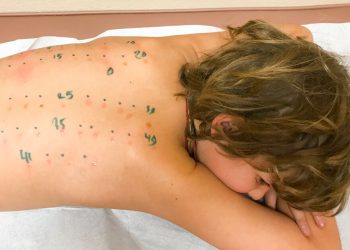 Meals allergic reactions in kids, what mother and father have to know