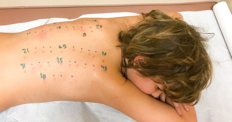 Meals allergic reactions in kids, what mother and father have to know