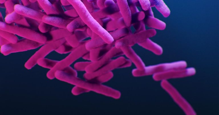Confirmed case of tuberculosis at Highline Faculty – KIRO 7 Information Seattle