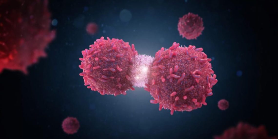 How Way of life Adjustments And Early Detection Can Assist Forestall Ovarian Most cancers