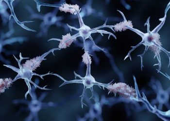 Sitting Time Linked to Mind Shrinkage and Alzheimer’s Threat