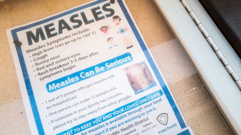 Measles math: What to learn about 1,001 measles circumstances throughout the nation : Photographs