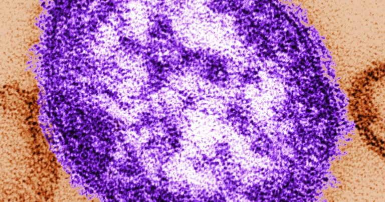 Colorado confirms first measles outbreak of 2025 amid uptick in statewide instances