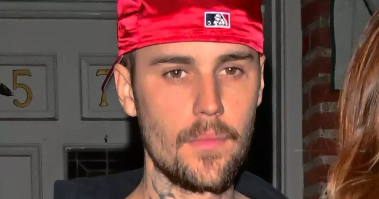 Justin Bieber sparks concern from followers as he steps out with thriller damage as followers diss his style