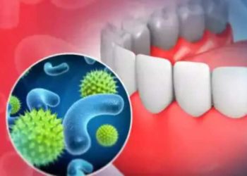 There’s a relationship between mouth micro organism and melancholy, examine finds |