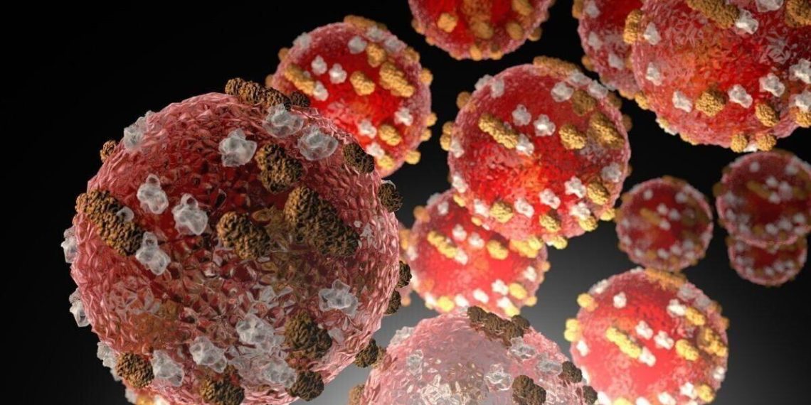 Measles publicity alert in Helena prompts well being response | Helena Information