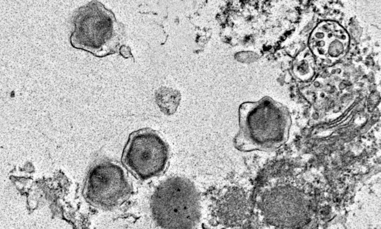 Large viruses hijack ocean crops to manage marine meals webs