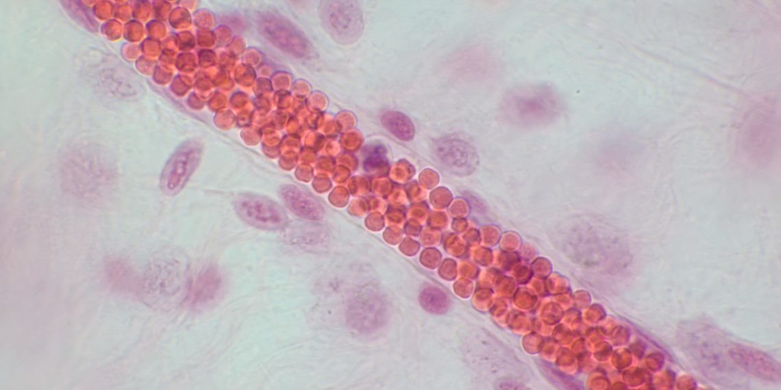 Examine reveals MMA sparring hits blood well being tougher than boxing