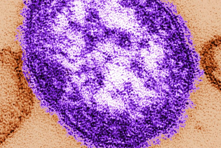 DC well being officers verify case of measles