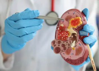 World Kidney Most cancers Day: What Are The Causes, Signs And Prevention? | Way of life Information