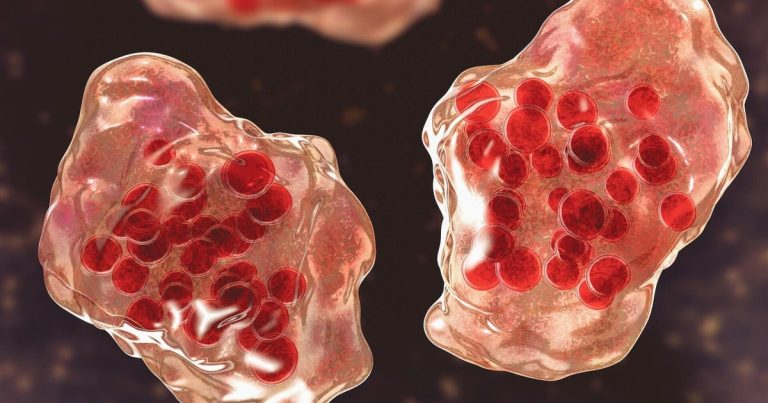 Public well being officers affirm new measles case in LA County