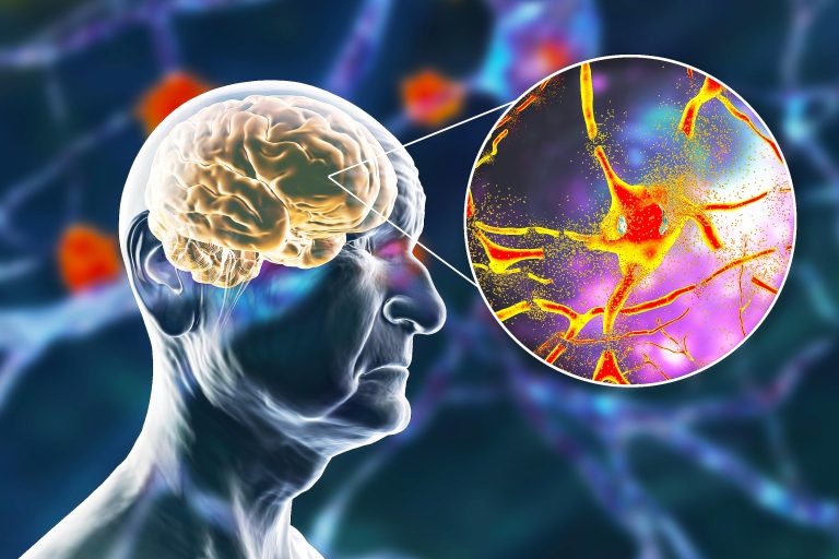 This life-style issue is the largest contributor to cognitive decline