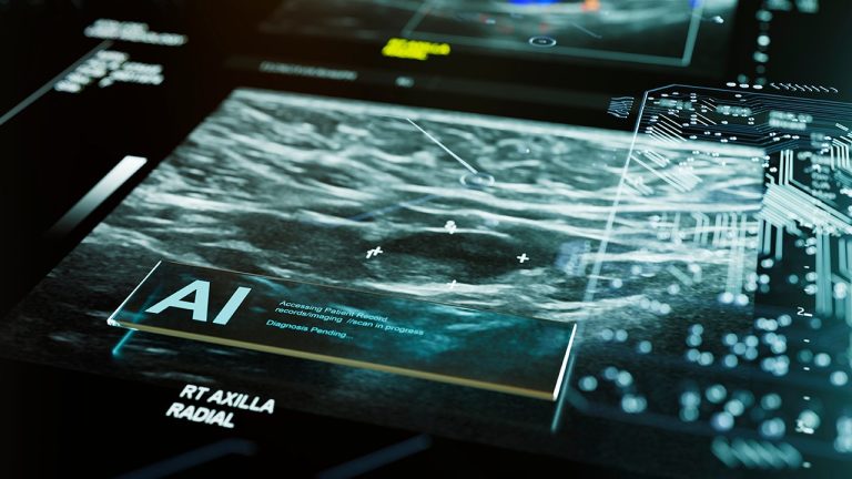 FDA approves the primary instrument AI to foretell the chance of breast most cancers