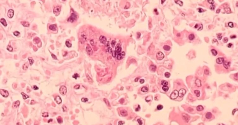 Well being officers warn about measles publicity at Rochester Hills medical constructing